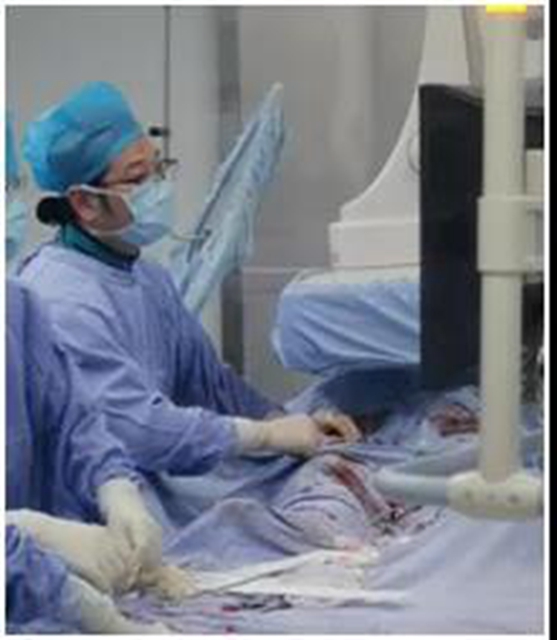 泸州市人民医院多学科团队完成首例髂股动脉血管支架手术(图2)