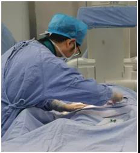 泸州市人民医院多学科团队完成首例髂股动脉血管支架手术(图3)