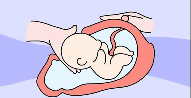 【扩散】顺产vs剖腹产，准妈妈们该怎么选？(图5)