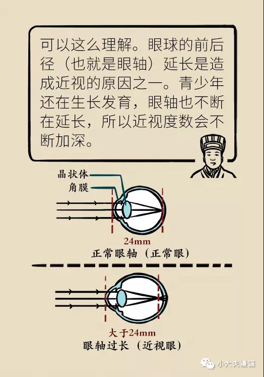 暑假到，配镜忙，OK镜真能缓解孩子近视？看专家解答(图9)
