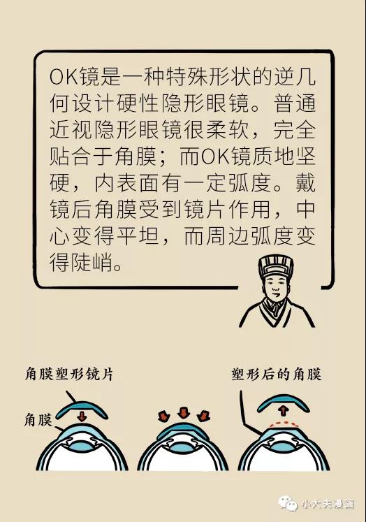 暑假到，配镜忙，OK镜真能缓解孩子近视？看专家解答(图7)