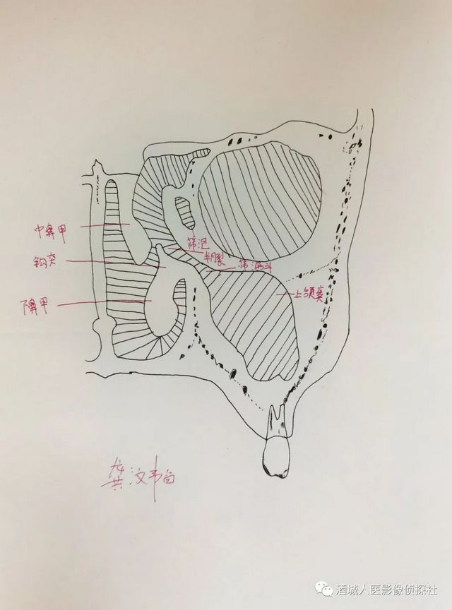 生命之美——医学影像科实习学生寒假作业等你来投票！！(图5)