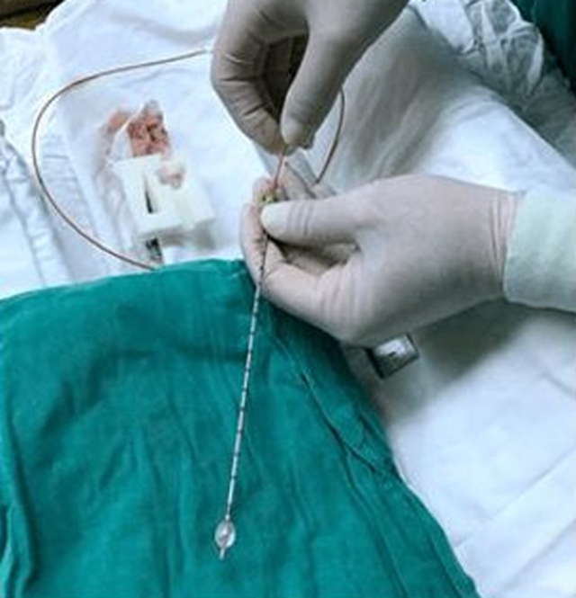 泸州一老人脸被“刀割”，痛不欲生！(图8)