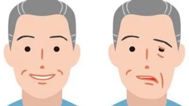 天气变化，女子竟开始流口水？(图10)