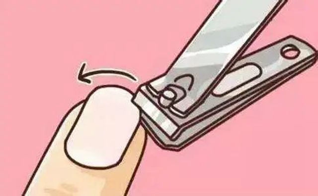 十指连心痛，泸州小伙踢球整出甲沟炎！(图7)