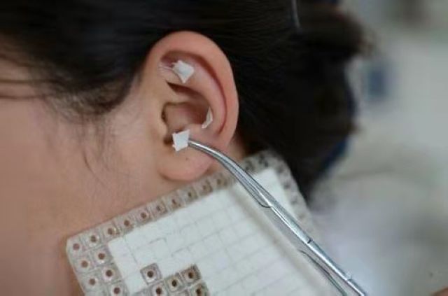 【扩散】爆火的中医特色诊疗技术，不限额免费体验！(图4)