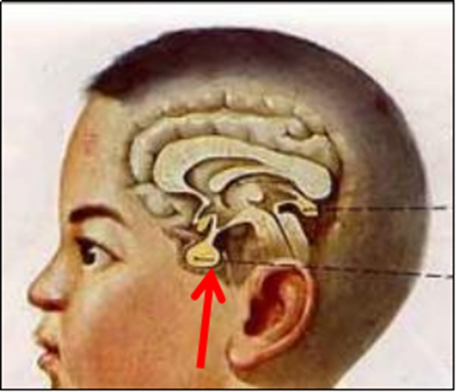 【扩散】孩子长太高?警惕脑子出问题!(图2) 【扩散】孩子长太高?警惕脑子出问题!(图2)