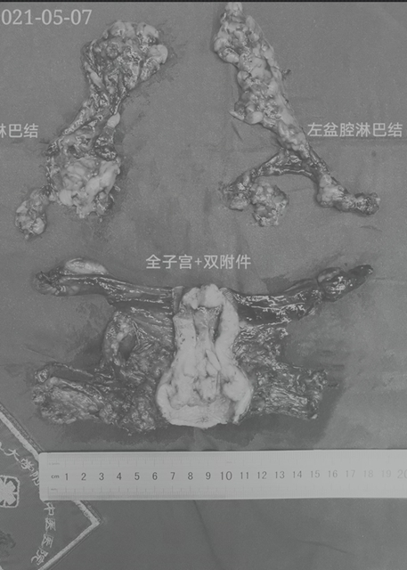【人物】靠技术圈粉的妇科男医生(图4)
