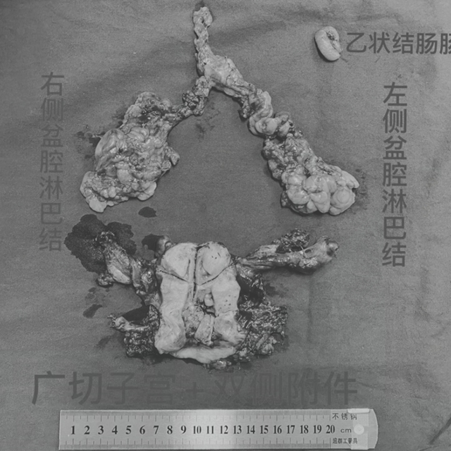 【人物】靠技术圈粉的妇科男医生(图5)