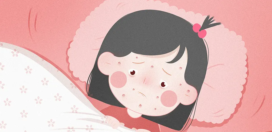 【关注】孩子踏青回来一身疹!怎么办?(图4) 1.png