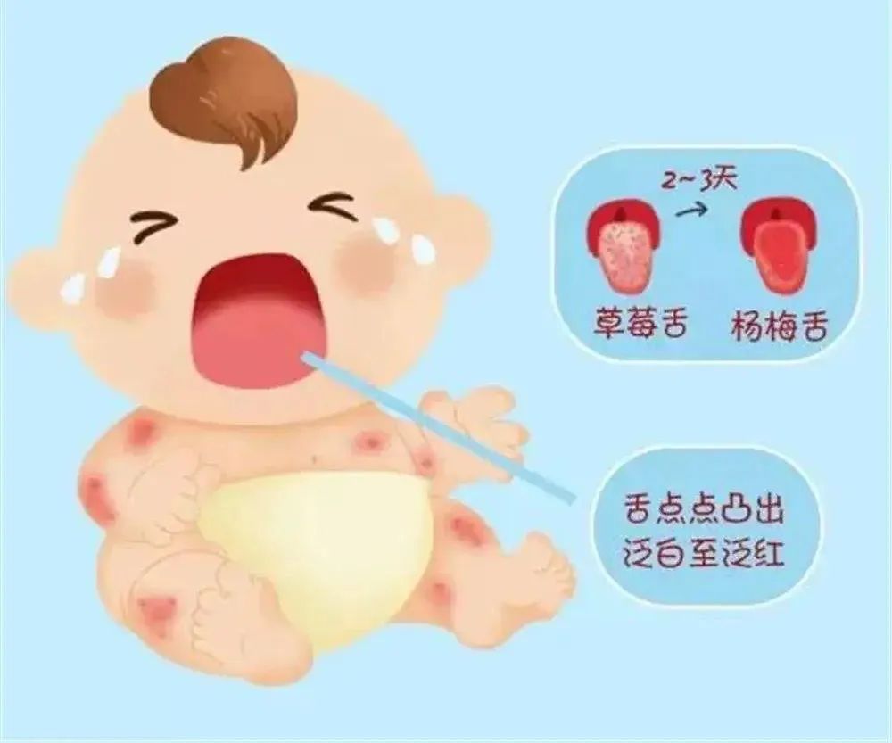 【关注】孩子踏青回来一身疹!怎么办?(图5) 4.jpg