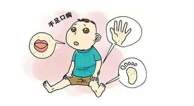 【关注】孩子踏青回来一身疹!怎么办?(图7) 6.jpg