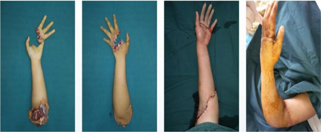 【关注】“4大金刚”亮相西南医大中医院?(图10)