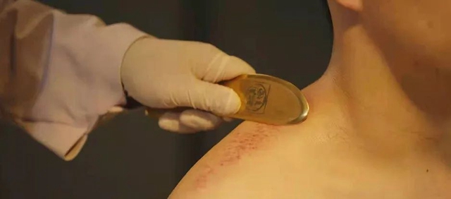 【关注】“4大金刚”亮相西南医大中医院?(图17)