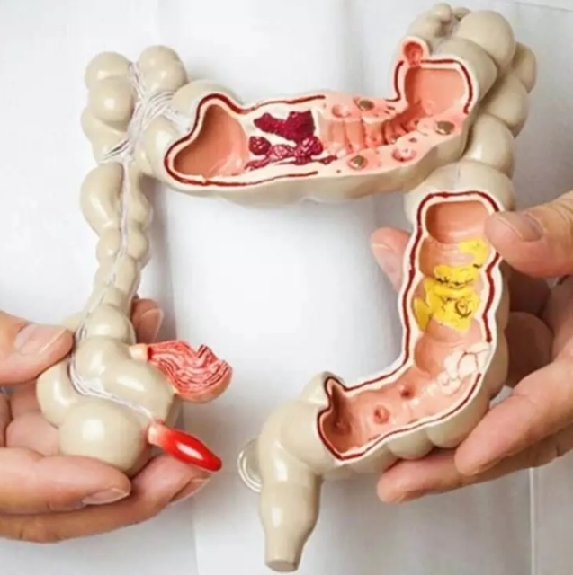 【警惕】癌症要遗传?特别是这6种!(图4) 4.jpg