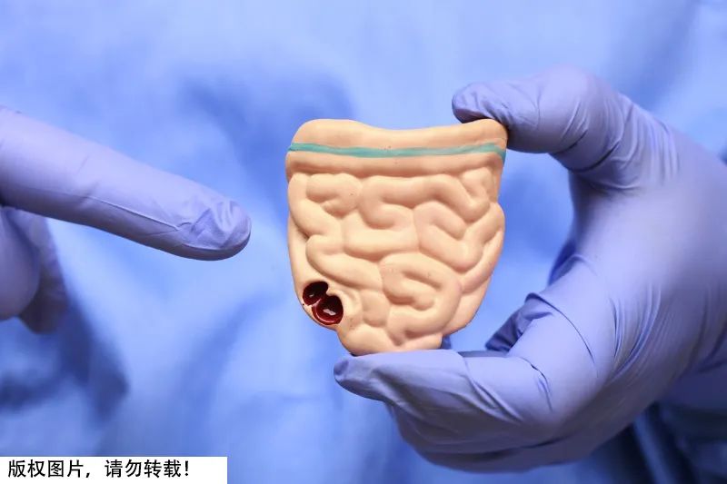 【分享】7种"催老剂"藏在日常食物中,尽量少碰!(图3) 3.jpg