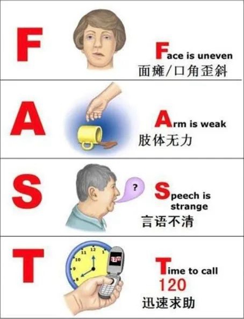 83岁大爷突发脑梗,市人医团队紧急施救挽回生命(图3) 3.jpg
