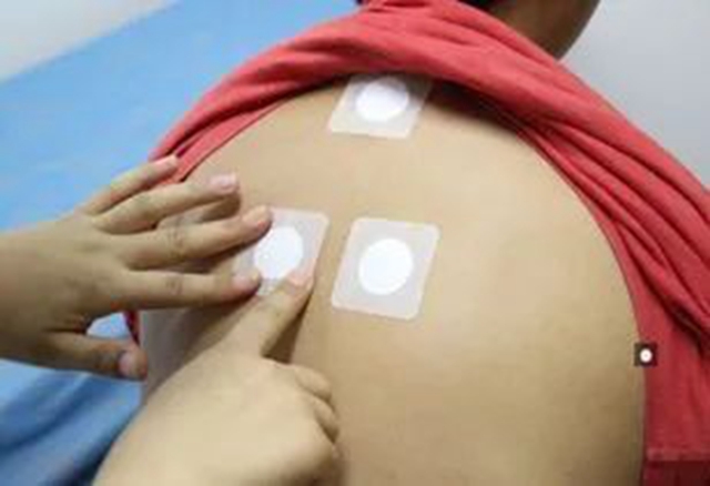 “贴敷助您除冬病” 泸州市人民医院康复医学科“三伏贴”开始了!(图2) 2.jpg