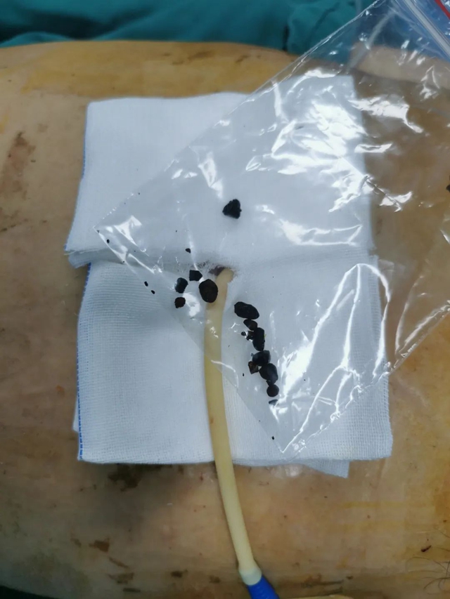 除病痛、解疾忧!入驻泸州市中医医院城南院区四个月他们与病人“肝胆相照”!(图3) 3.jpg