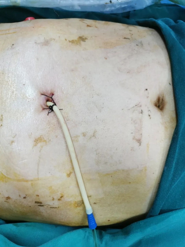 除病痛、解疾忧!入驻泸州市中医医院城南院区四个月他们与病人“肝胆相照”!(图4) 4.jpg