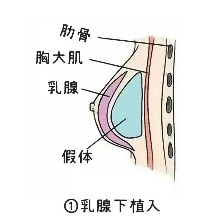 【关注】真正靠谱的丰胸办法,只有这两个!(图5) 3.jpg