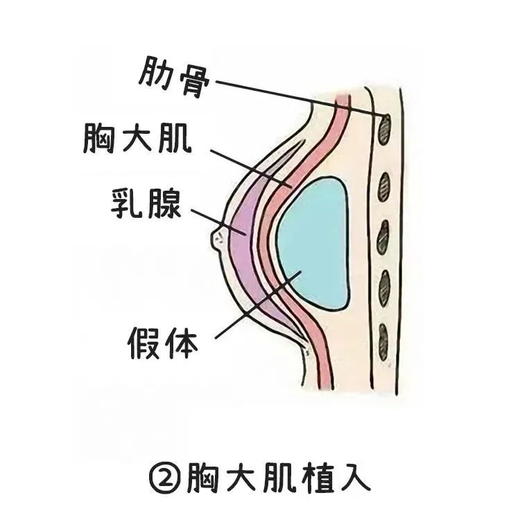 【关注】真正靠谱的丰胸办法,只有这两个!(图6) 4.jpg