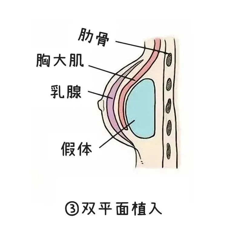 【关注】真正靠谱的丰胸办法,只有这两个!(图7) 5.jpg