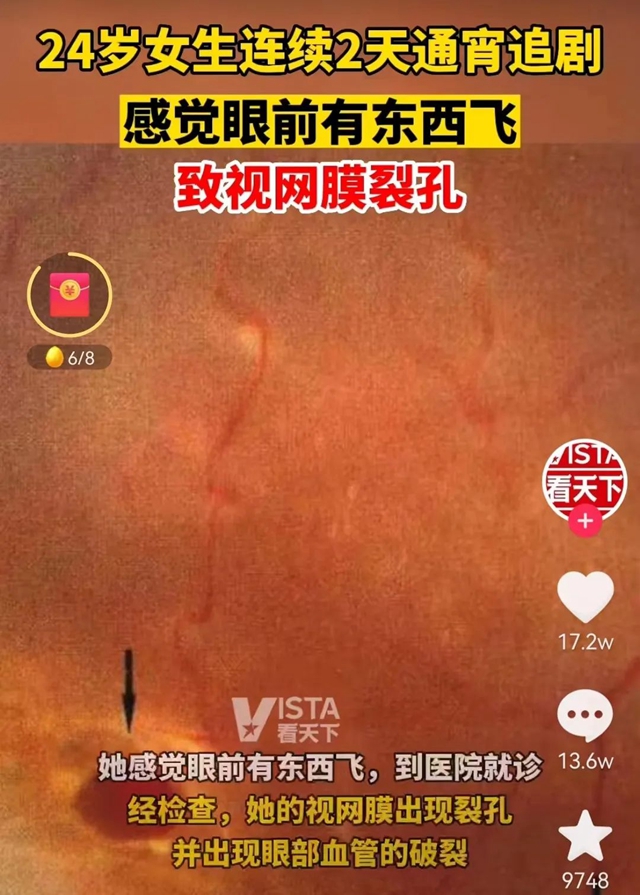 【警惕】通宵追剧，24岁女子差点瞎了