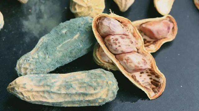 【警惕】肝癌最偏爱5个字,看看你中几个!(图5) 5.jpg