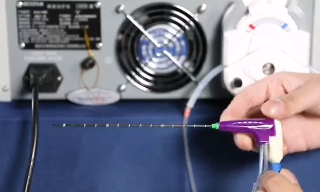 【扩散】男子患骨肿瘤,差点截肢?(图5) 5-1.jpg