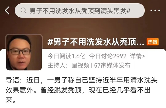 【围观】清水洗头，反而不脱发了？