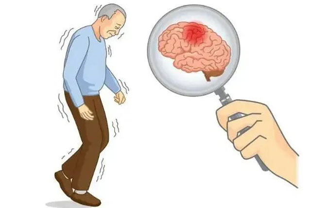 【警惕】吃完饭就犯困、头晕,咋回事?(图3) 3-1.jpg