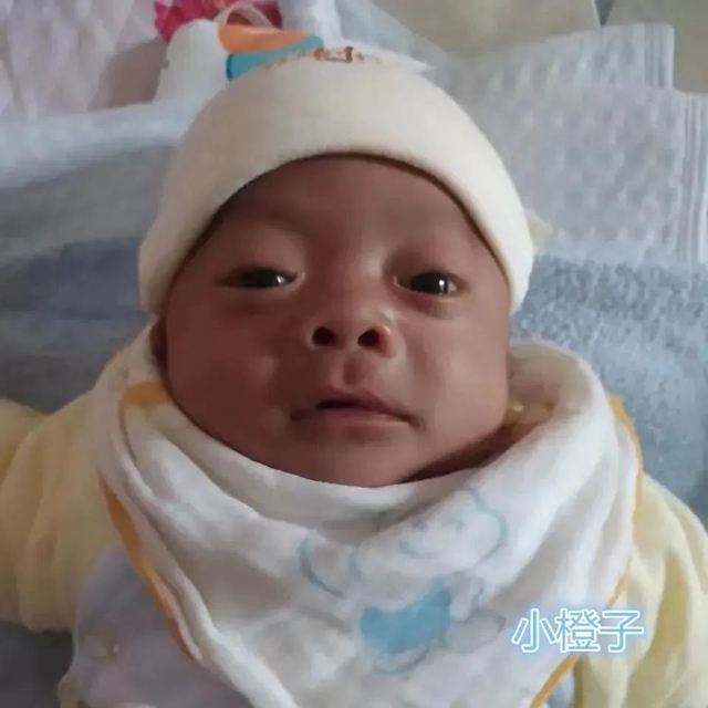 【围观】83天！体重不到2斤的宝宝活下来了