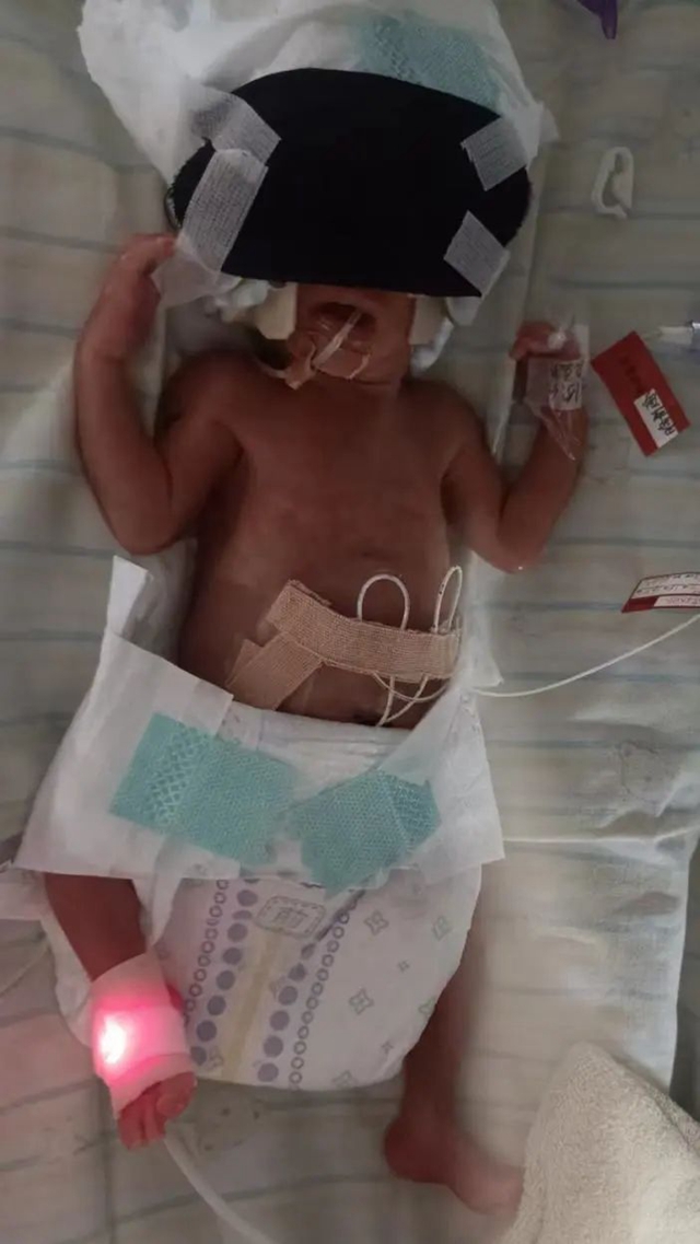 【围观】83天!体重不到2斤的宝宝活下来了(图3) 3.jpg