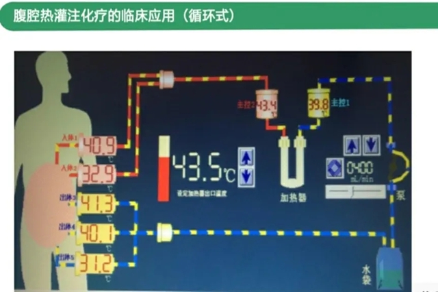 【围观】43℃!“烫死”癌细胞(图4) 4.jpg