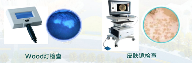 【关注】得了白癜风,可以这样治疗!(图3) 3 副本.jpg