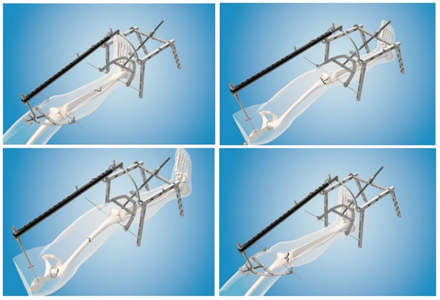 【围观】断手断脚?古法技术有特效!(图2) 2.jpg