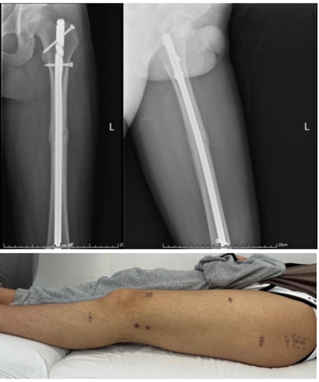 【围观】断手断脚?古法技术有特效!(图5) 5.jpg