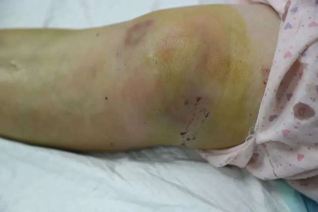 【警惕】蛇来了!今年第一个遭殃的竟然是……(图4) 4.jpg