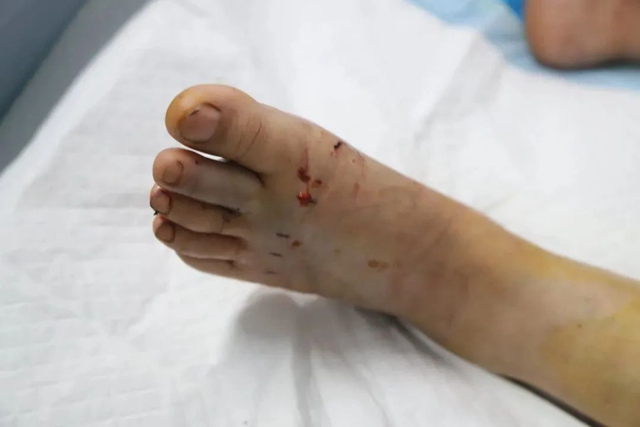 【警惕】蛇来了!今年第一个遭殃的竟然是……(图3) 3.jpg