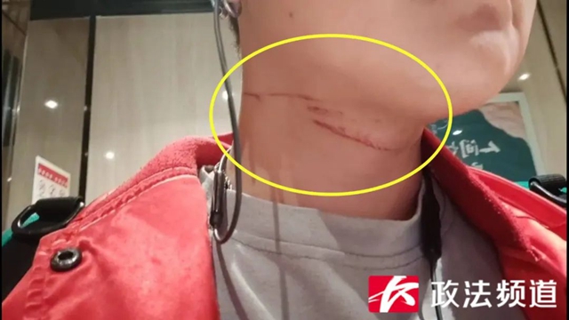 【分享】有人险遭割喉！千万小心这根“夺命”线