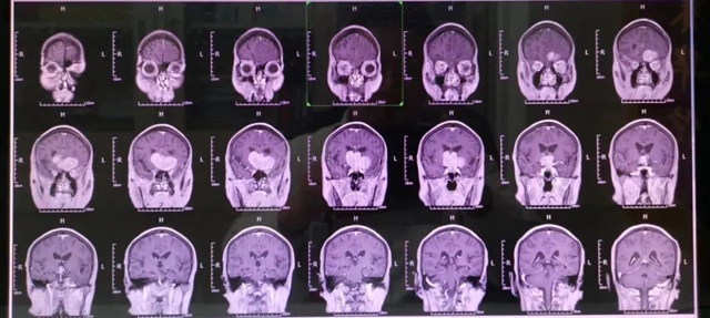 【硬核】16名“开脑壳”的医生啥样?(图2) 2.jpg
