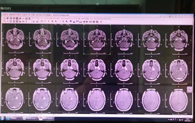 【硬核】16名“开脑壳”的医生啥样?(图8) 8.jpg