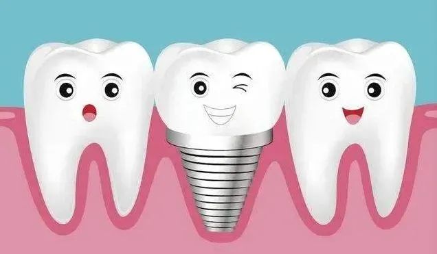 西南医大中医院 口腔种植医疗费用正式下调!(图3) 3.jpg