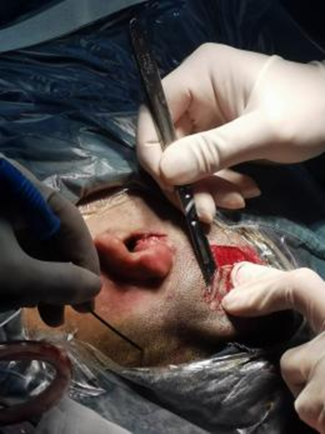 【厉害了】首例!(图2) 2.jpg