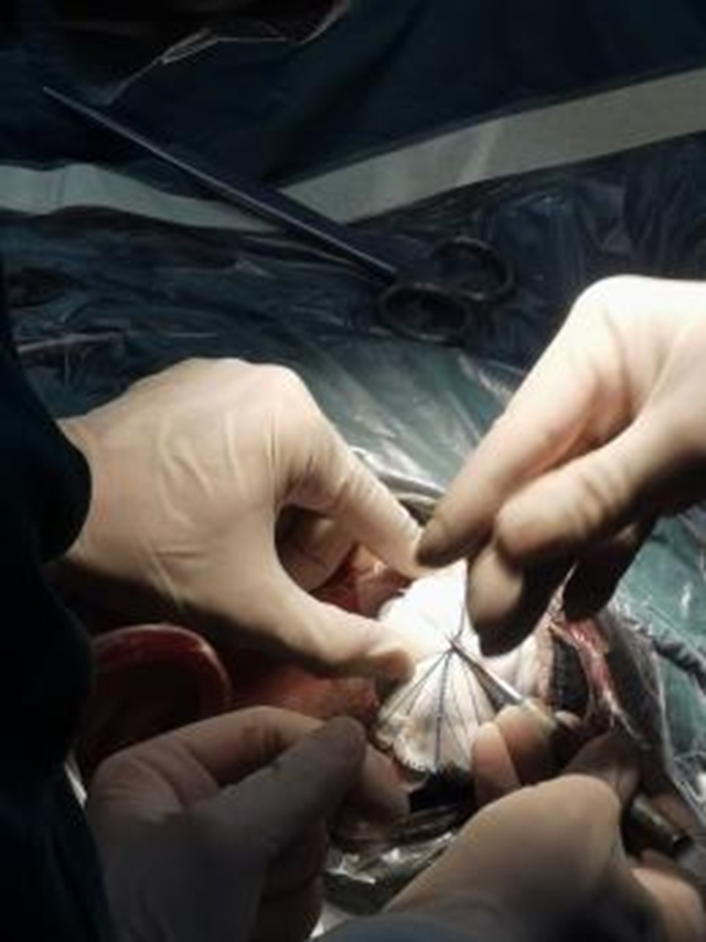 【厉害了】首例!(图3) 3.jpg