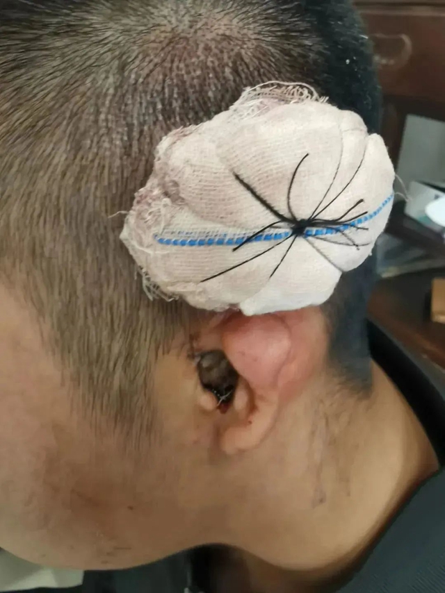 【厉害了】首例!(图5) 5.jpg