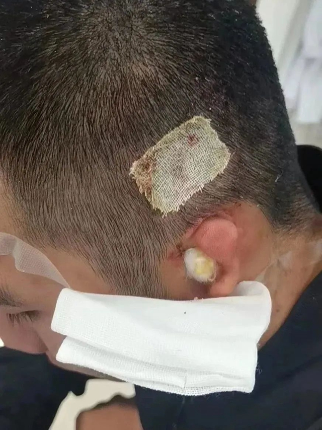 【厉害了】首例!(图4) 4.jpg