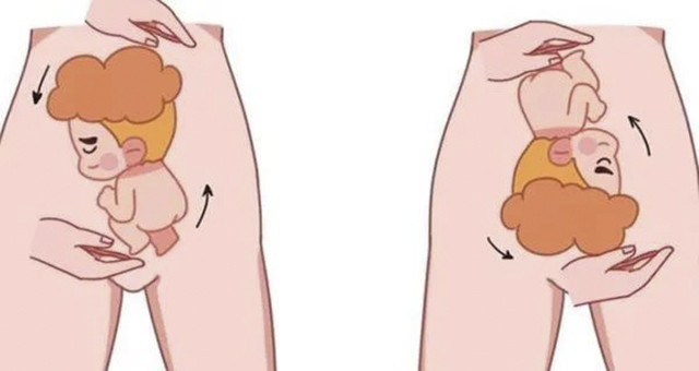 【展绝技】仅一分钟,医生隔肚皮徒手扭转胎位不正(图1) 1.jpg