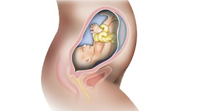 【展绝技】仅一分钟,医生隔肚皮徒手扭转胎位不正(图4) 4.jpg